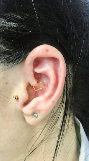 TRAGUS - DAITH - LÓBULO